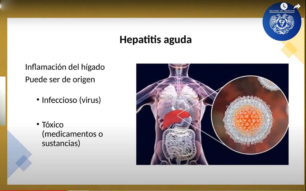 Estos Son Los S Ntomas Que Preceden A Casos De Hepatitis Aguda Grave En