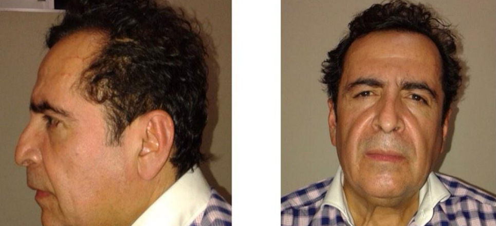 Héctor Beltrán Leyva, 'El H', capturado mientras comía en San Miguel Allende Héctor Beltrán Leyva, 'El H', capturado mientras comía en San Miguel Allende