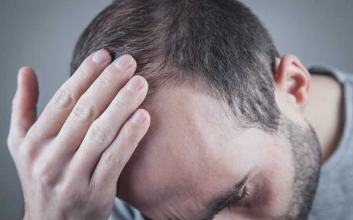 Estados Unidos aprueba la primera tableta para tratar la calvicie severa Estados Unidos aprueba la primera tableta para tratar la calvicie severa