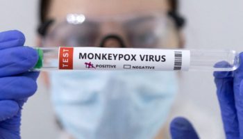 No más viruela del mono: la OMS busca renombrar a la enfermedad para evitar estigmas