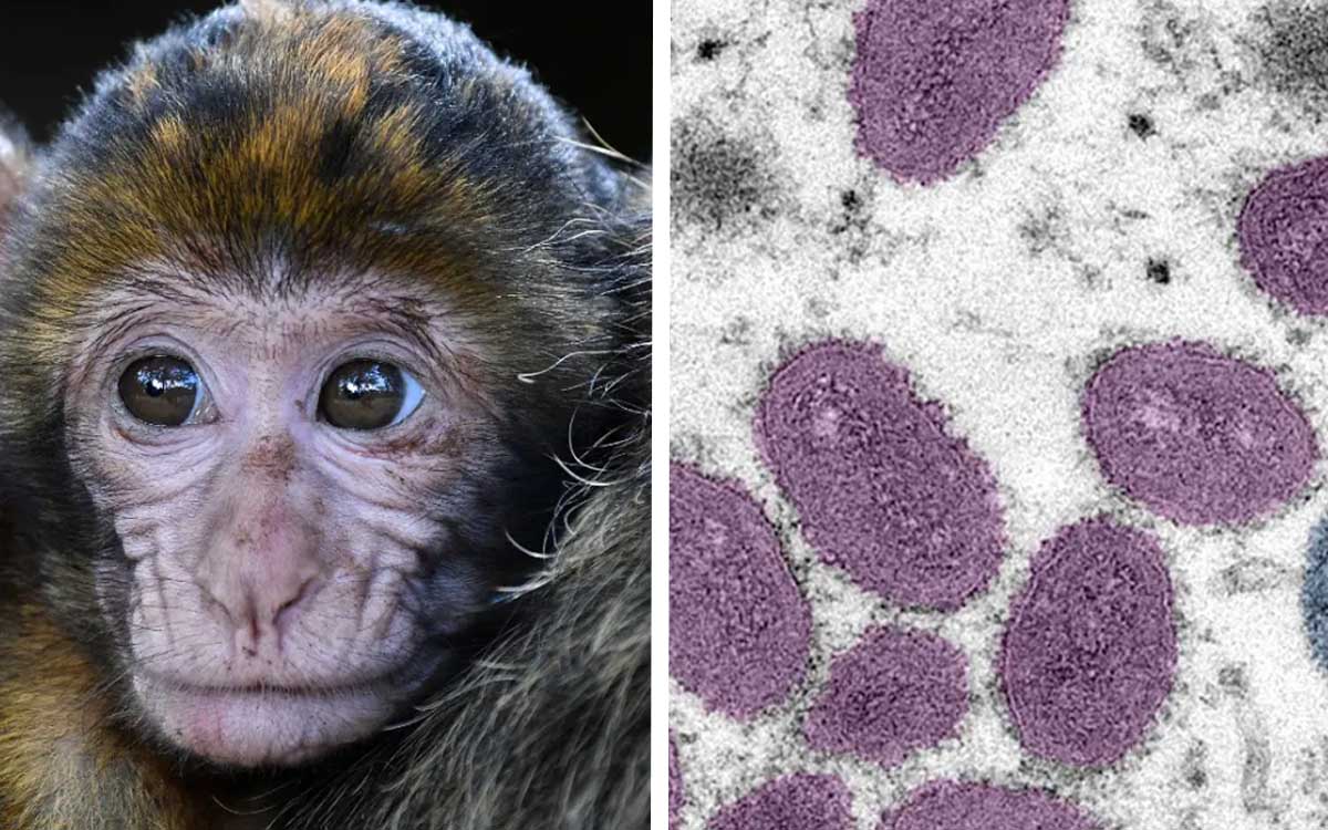 Un virus de monos similar al ébola está 'preparado para contagiar' a los humanos, advierte estudio Un virus de monos similar al ébola está 'preparado para contagiar' a los humanos, advierte estudio