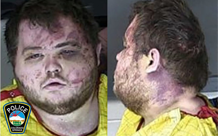 El acusado por tiroteo en bar LGBT+ en EU aparece aturdido y con moretones en audiencia El acusado por tiroteo en bar LGBT+ en EU aparece aturdido y con moretones en audiencia