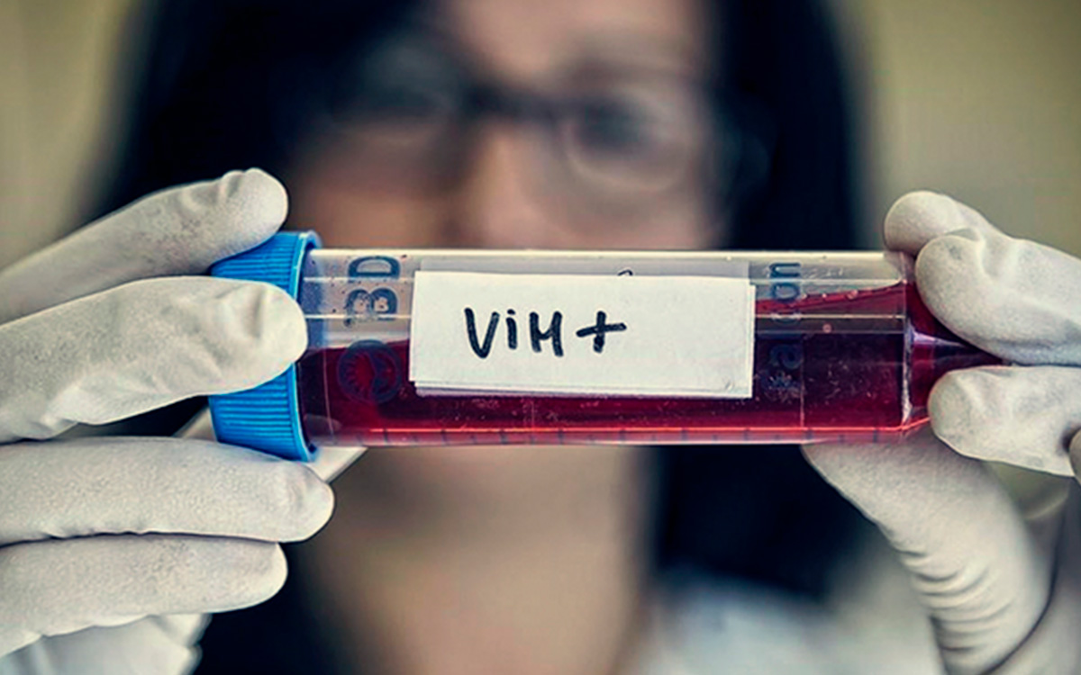 US increased by 300 people on HIV treatment in 20 years