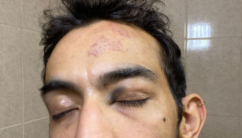 Golpean a comediante con sordera en 7 Eleven de la CDMX