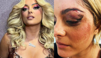 Golpean a Bebe Rexha en pleno concierto | Video