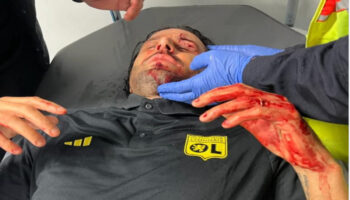 Paga técnico del Olympique Lyon por la ola de violencia en el futbol galo | Video