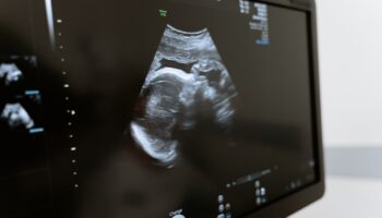 Tribunal Supremo de Arizona revive una prohibición del aborto de 1864