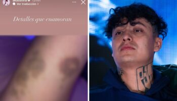 ¿Fue Alemán? Akasha, novia del rapero, comparte fotos de golpes y audio de pelea