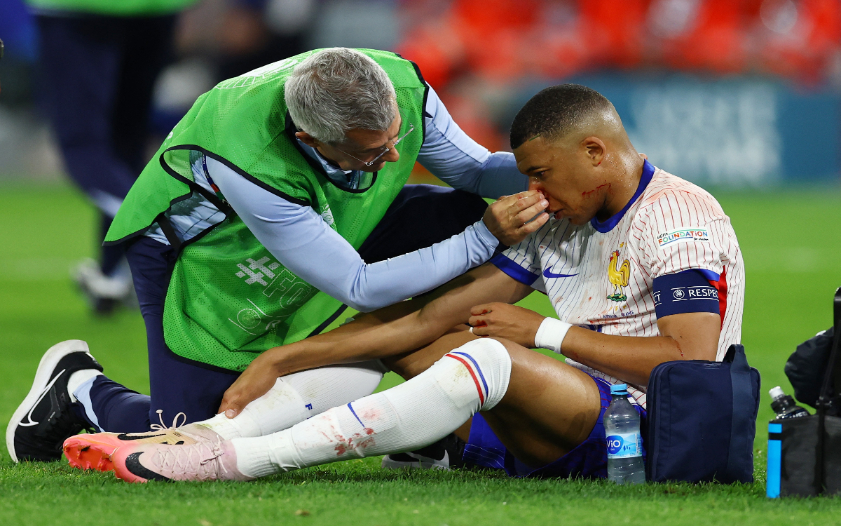 Euro Alemania 2024: Sufre Kylian Mbappé fractura de nariz | Fotogalería y Memes