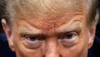 ‘Bala estuvo a 6 milímetros de entrar en su cabeza’: Médico de Trump