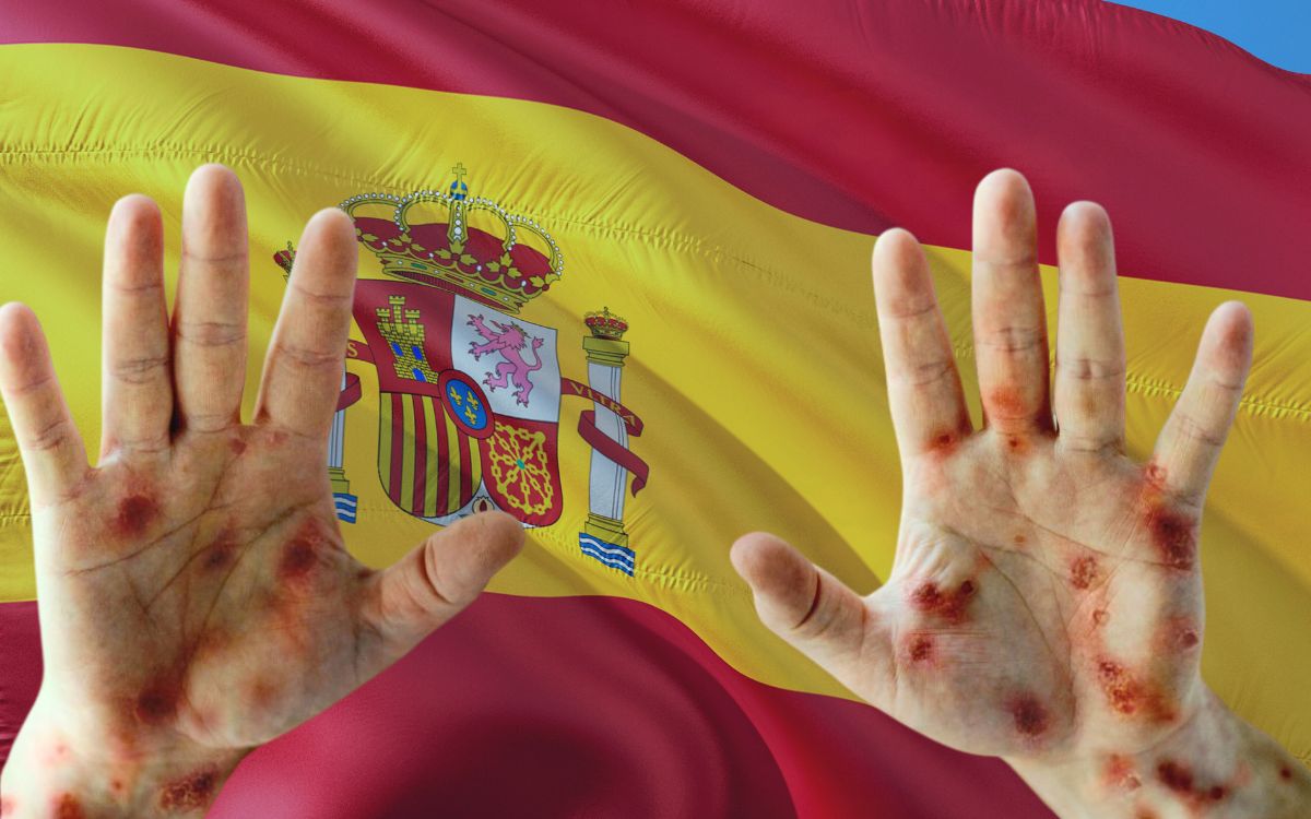 Spain: The European country with the highest incidence of smallpox: 8,104 cases.