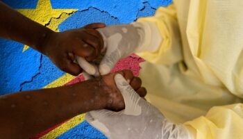 Médicos Sin Fronteras urge que vacunas contra mpox lleguen a África en 2 semanas