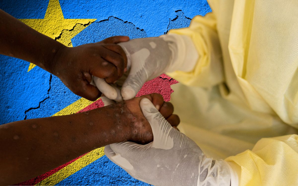 There have been 548 deaths from smallpox in the Democratic Republic of Congo.