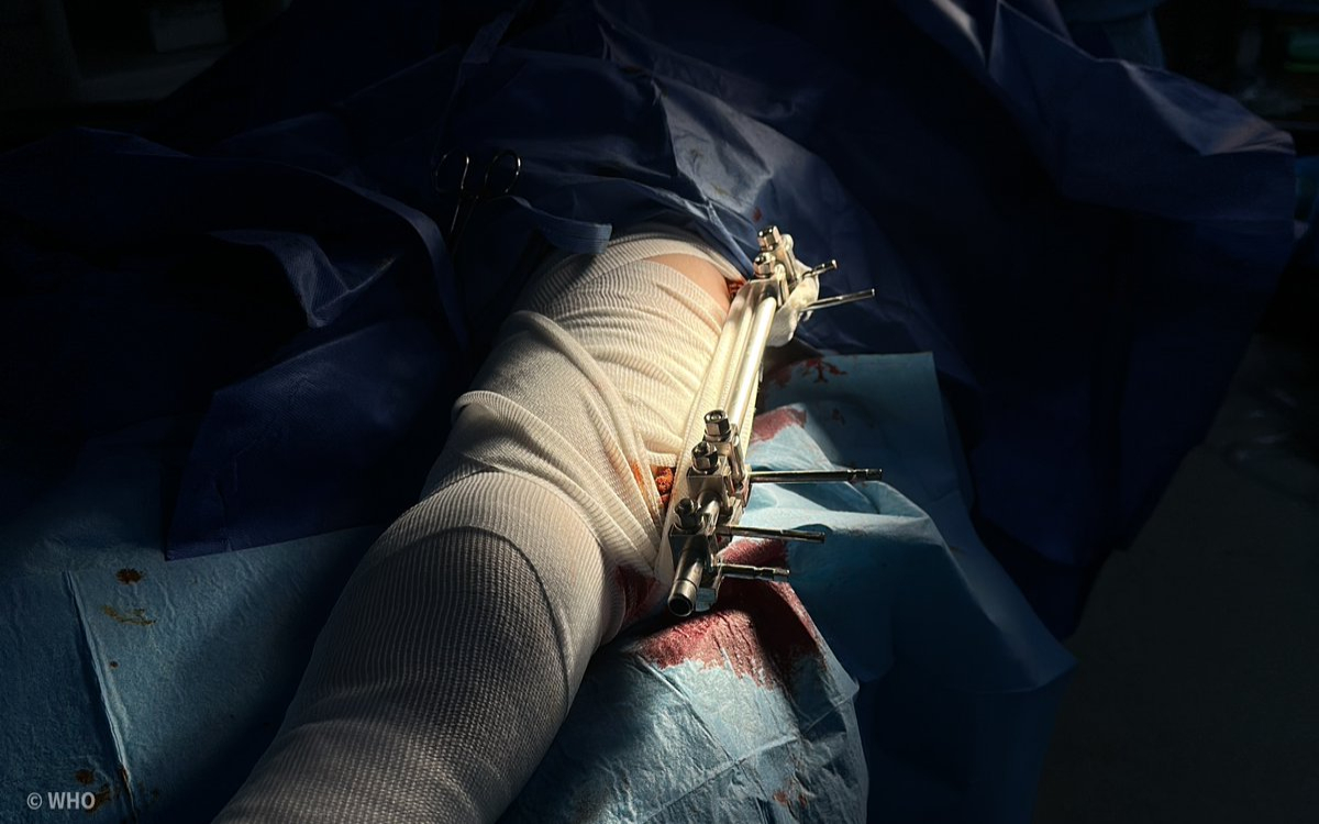 WHO warns Gaza casualties from Israeli offensive suffer serious physical consequences