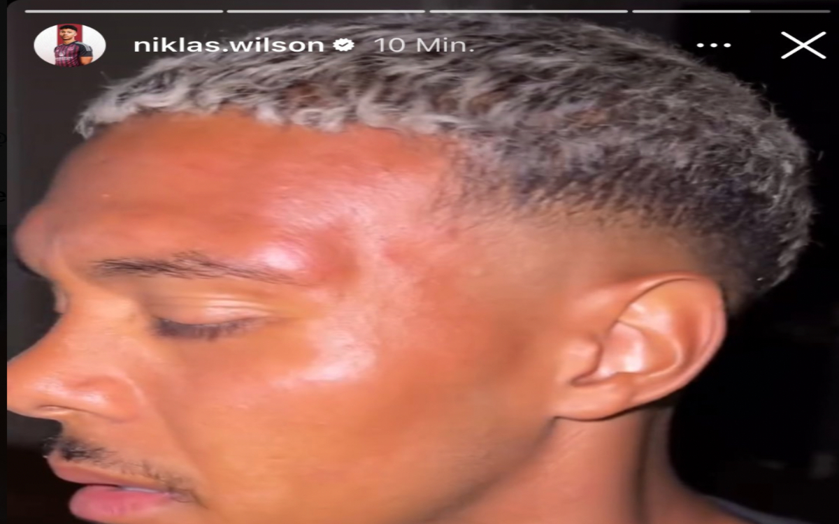 Golpean ultras a futbolista alemán por aparecer en foto con playera del acérrimo rival Golpean ultras a futbolista alemán por aparecer en foto con playera del acérrimo rival