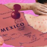 mpox salud mexico