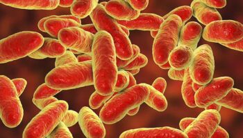 Contaminación por bacteria en Edomex probablemente se produjo durante la preparación de alimentos: infectólogo