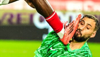 Así quedó el rostro de Donnarumma tras pisotón | Video