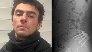 Dolor de espalda y odio anticorporativo, los posibles motivos de Luigi Mangione: Policía de NY