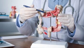 Obesidad y sedentarismo disparan el riesgo de cáncer colorrectal, advierten oncólogos