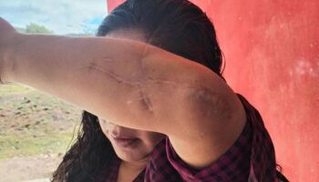 'Temo por mi vida, un juez liberó a quien quiso matarme': mixteca víctima de intento de feminicidio