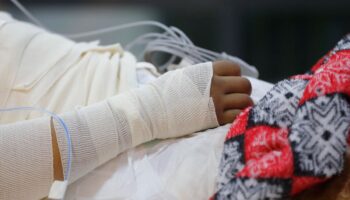 Quemaduras en adolescentes por pugnas del crimen ponen en alerta a expertos
