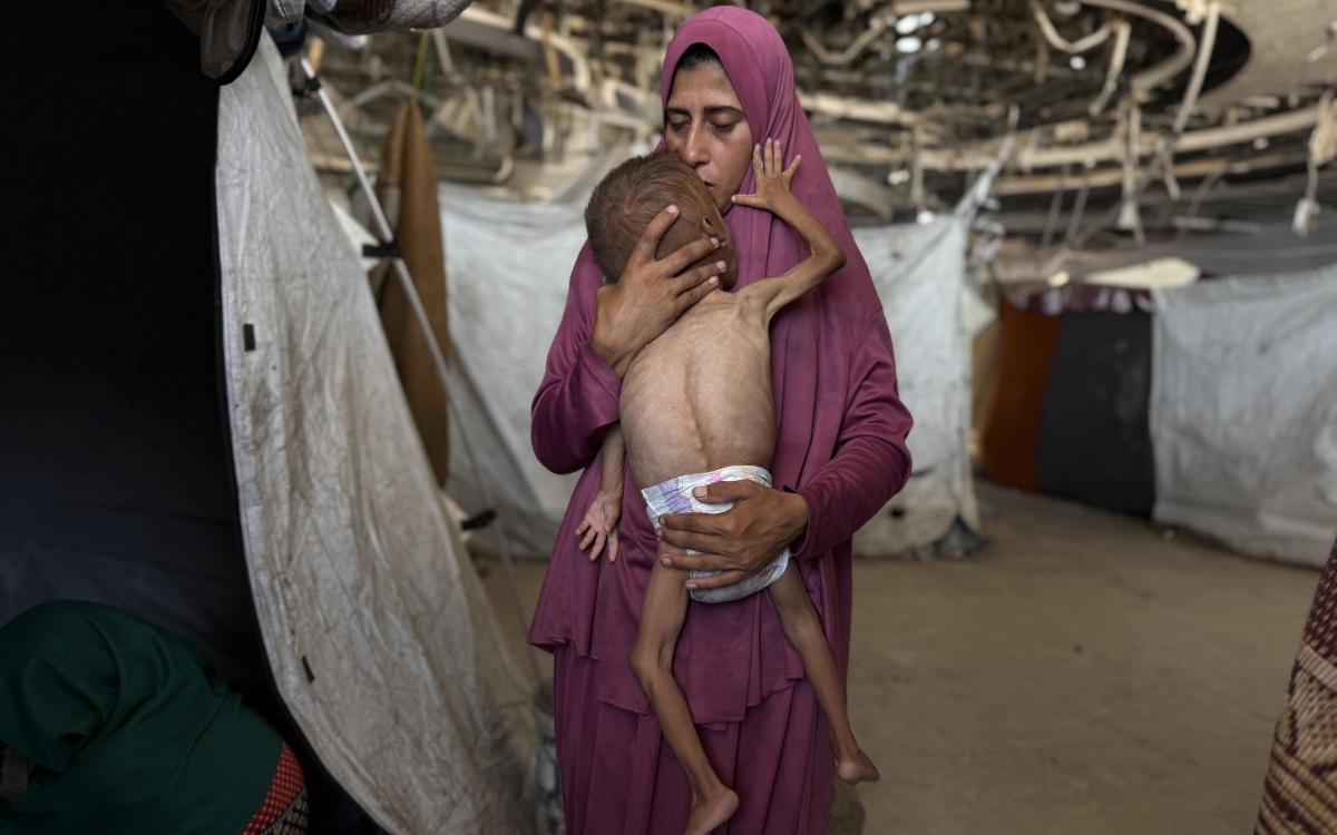 Más de 54 mil 600 menores sufren desnutrición severa en Gaza